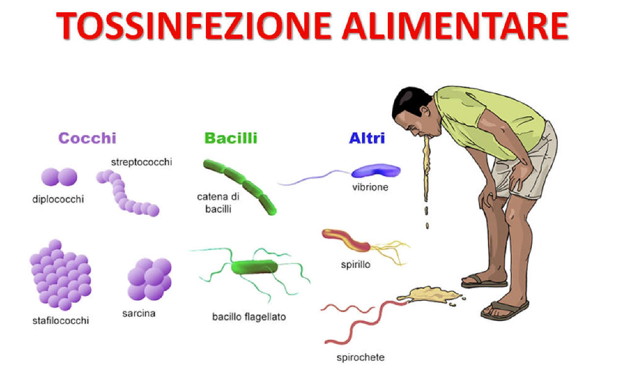 Tossinfezione alimentare